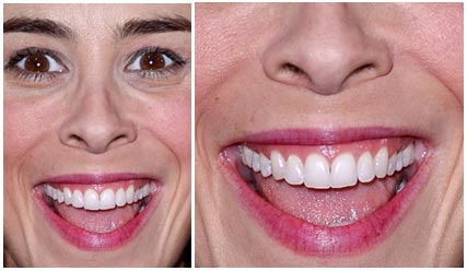 Comedian, Sarah Silverman | Nad's Nose Wax Comedian, Sarah Silverman | Nad's Nose Wax